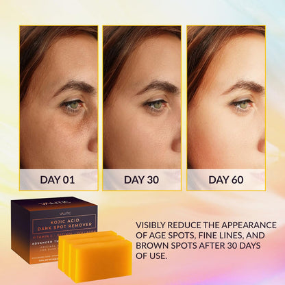 VALITIC Kojic Acid Dark Spot Remover Soap Bars with Vitamin C, Retinol, Collagen, Turmeric - Original Japanese Complex Infused with Hyaluronic Acid, Vitamin E, Shea Butter, Castile Olive Oil (2 Pack)