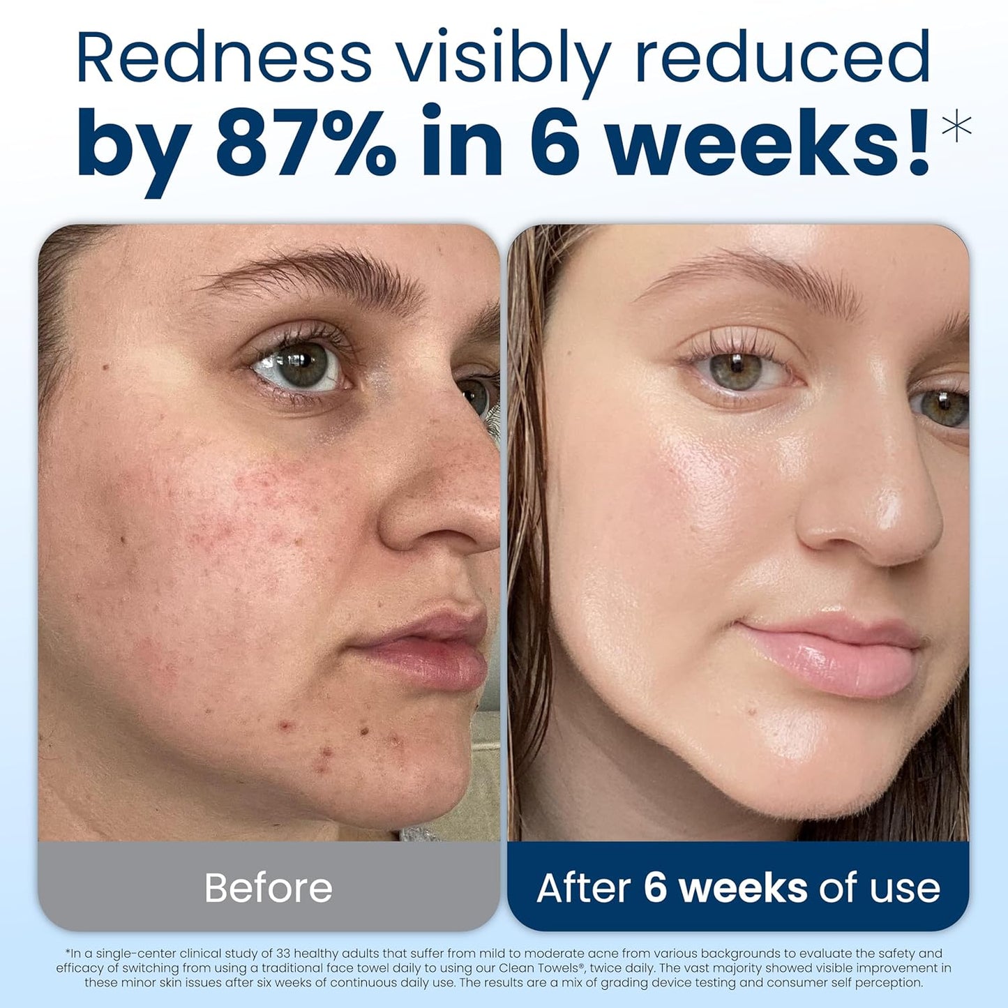 Clean Skin Club Clean Towels XL®, 100% USDA Biobased Face Towel, Disposable Face Towelette, Eczema Association Accepted, Makeup Remover Dry Wipes, Ultra Soft, 1 Pack, 50 Ct